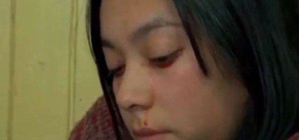 Yaritza Oliva: la ragazza che piange sangue. Yaritza Oliva: la ragazza che piange sangue.