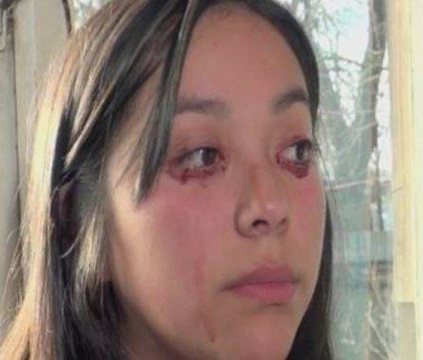 Yaritza Oliva: la ragazza che piange sangue. Yaritza Oliva: la ragazza che piange sangue.