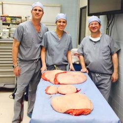 48-pounds-of-excess-skin-removed-from-Paul-Jonathan-Mason-after-surgery